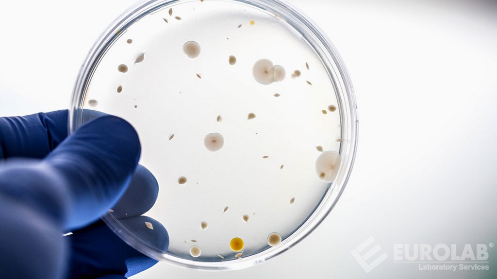 Tedavi Edilen Yara Örtülerinin Antimikrobiyal Etkinlik Testi